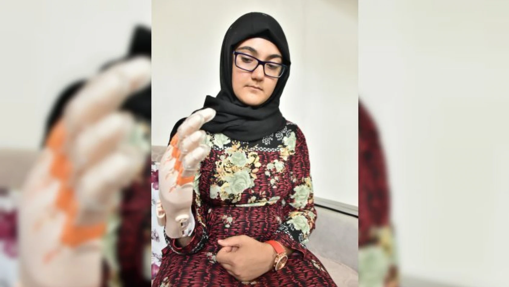 Lise öğrencileri 15 yaşındaki kıza protez el geliştirdi