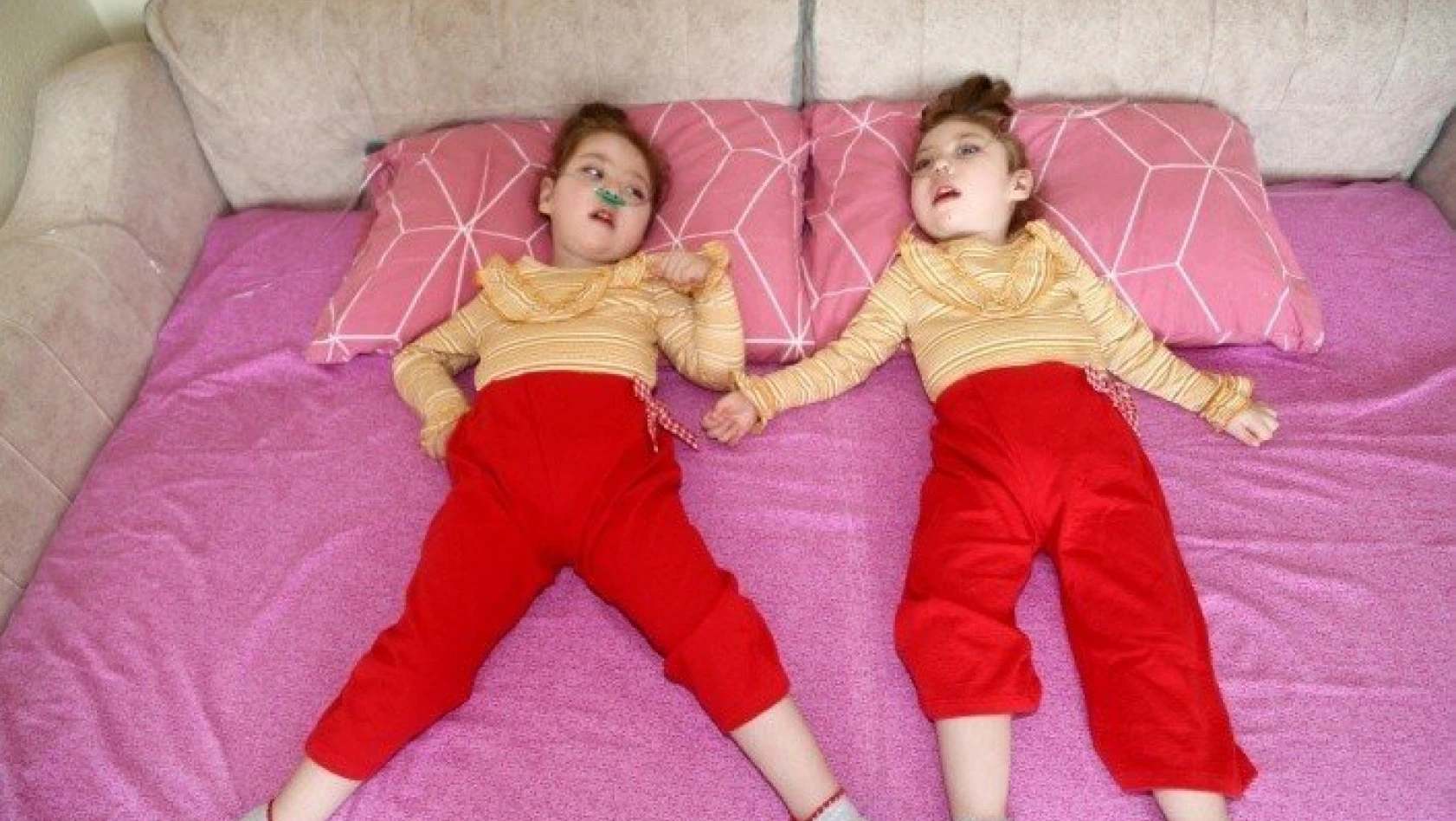 Hasta ikizlerin ailesi yardım bekliyor