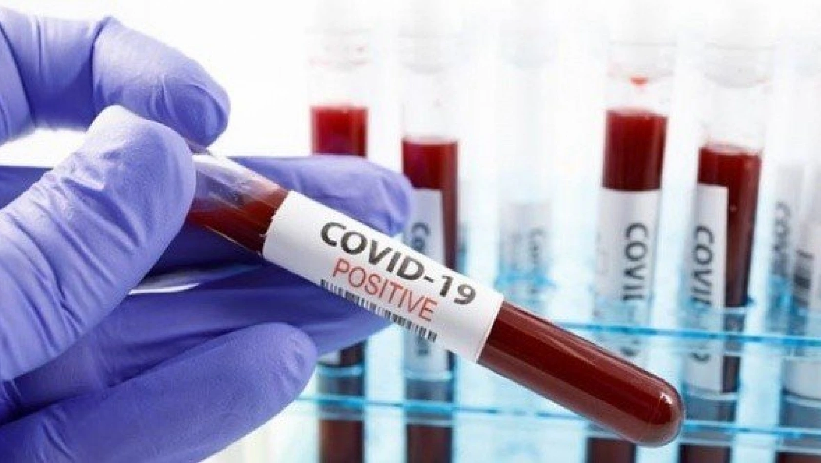 İstanbul'dan gelen ailede koronavirüs tespit edildi