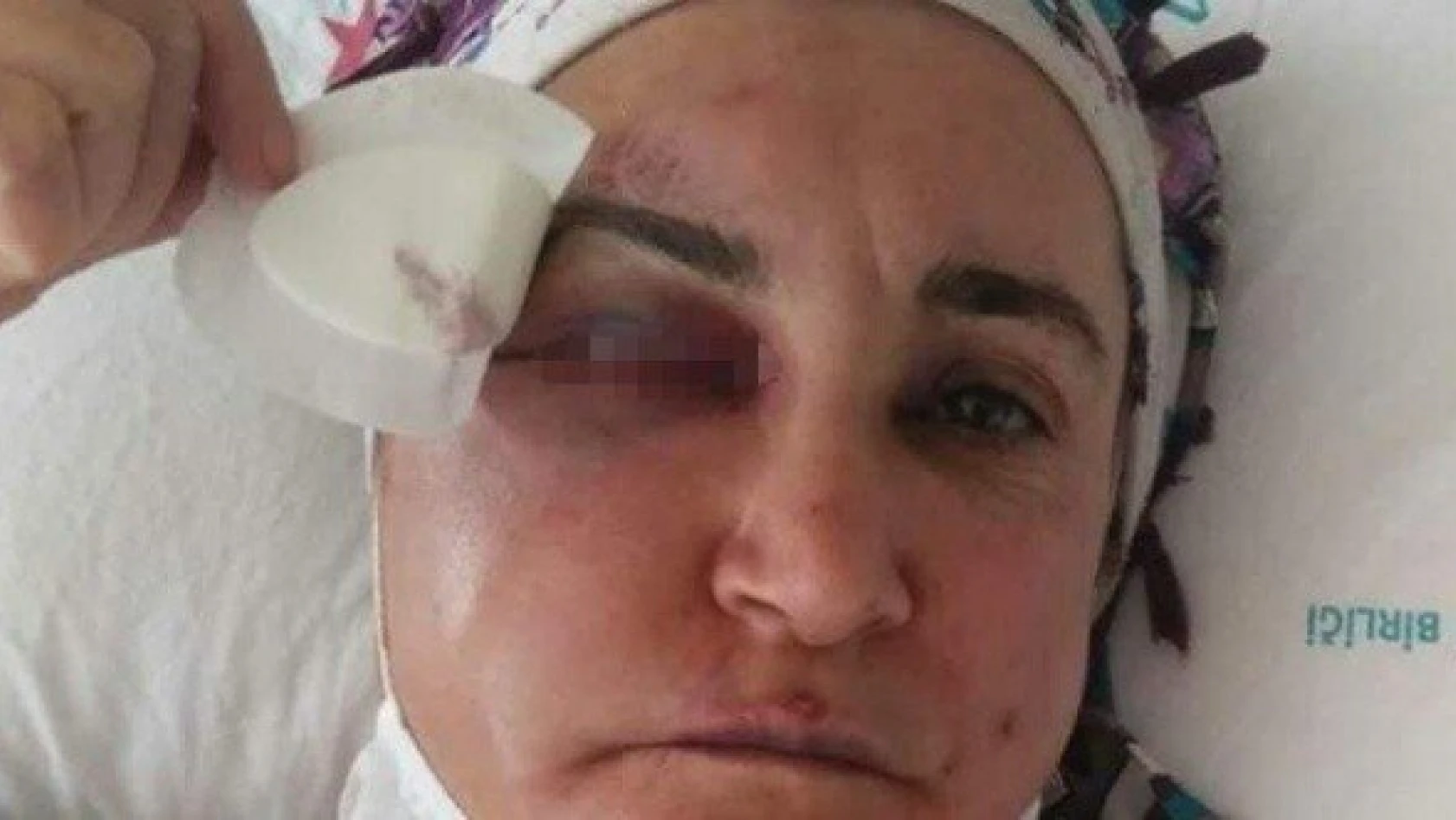 Sokakta kadınlara saldıran şahıs tutuklandı