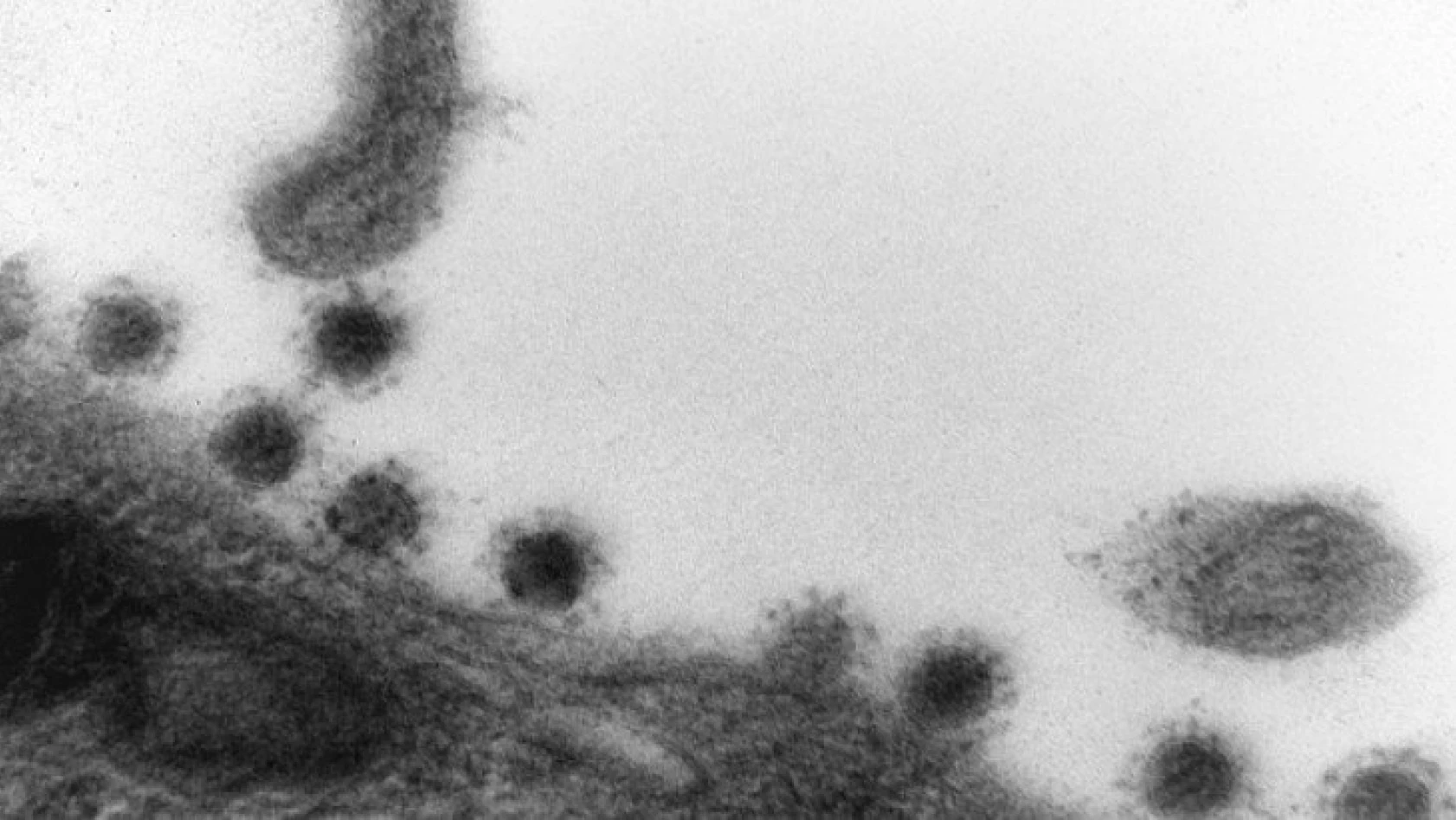 Koronavirüsün Delta Plus mutasyonu görüntülendi