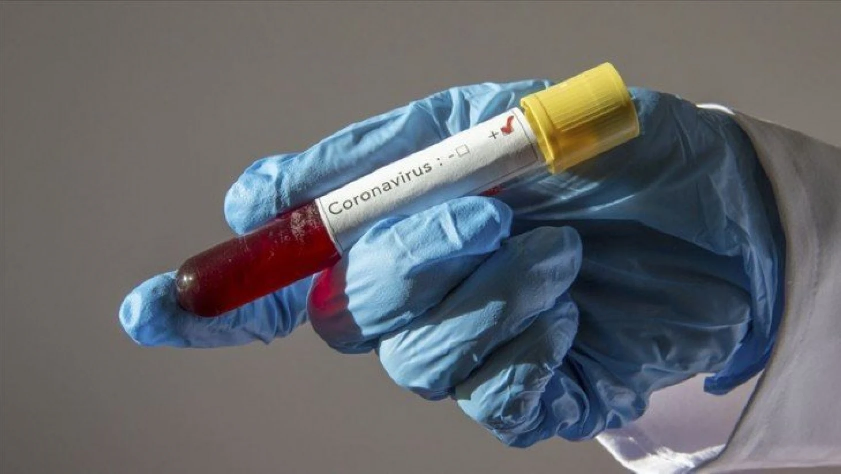 Bu merkezdeki sağlık çalışanlarının tamamı koronavirüse yakalandı